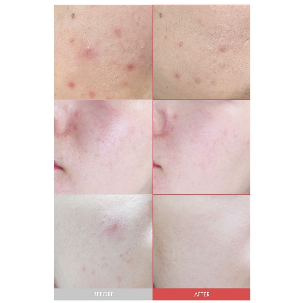 Dr. Ceuracle Azelaic 10 & Madeca Ampoule, 30ml